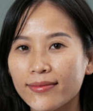 Book an Appointment with Yen Truong for Acupuncture